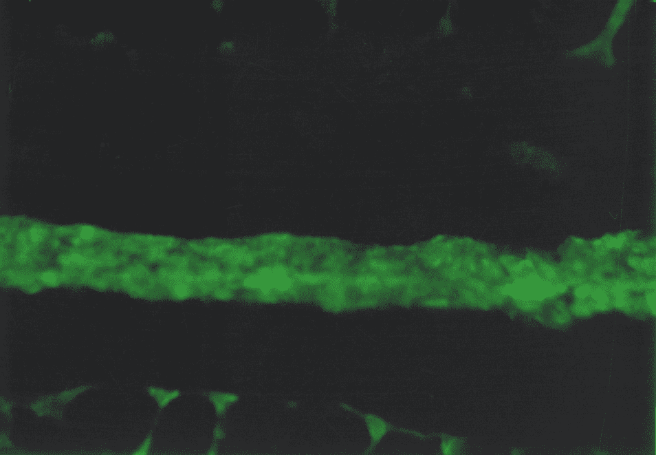 type IV collagen in the basal membrane