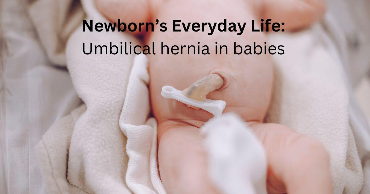2024) Newborn's Everyday Life: Umbilical Hernia In Babies (Part 3)