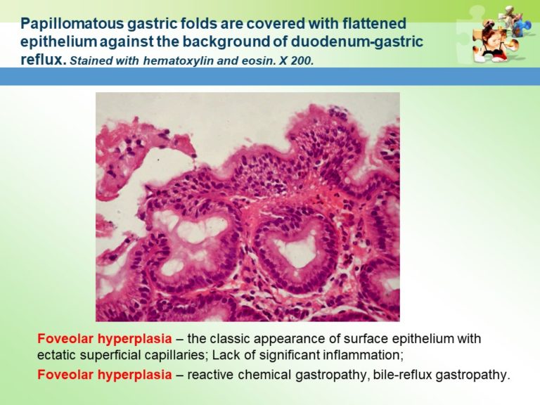 Prevention of Gastrointestinal Pathology Slide14
