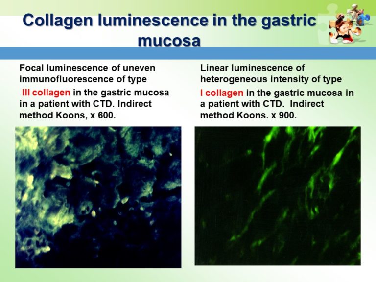 Prevention of Gastrointestinal Pathology Slide16