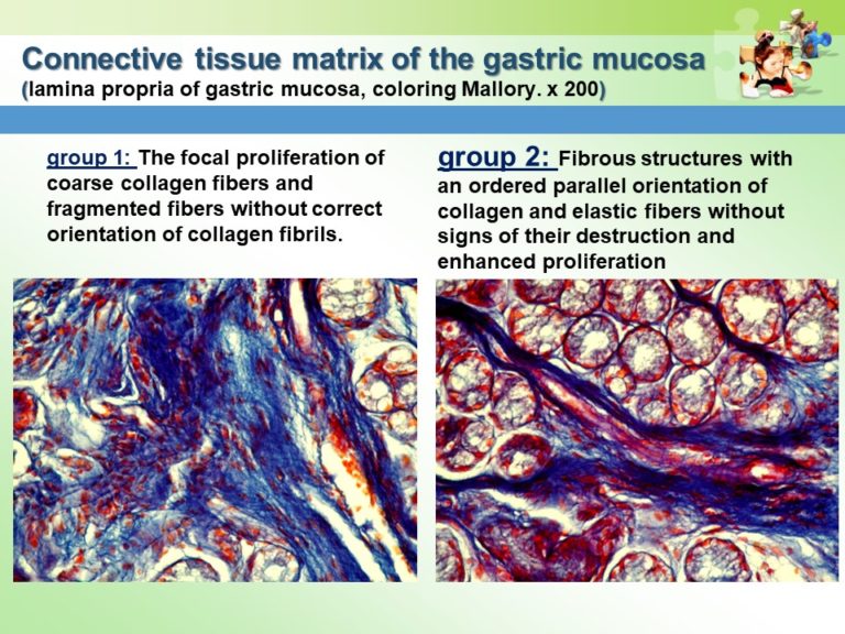 Prevention of Gastrointestinal Pathology Slide17