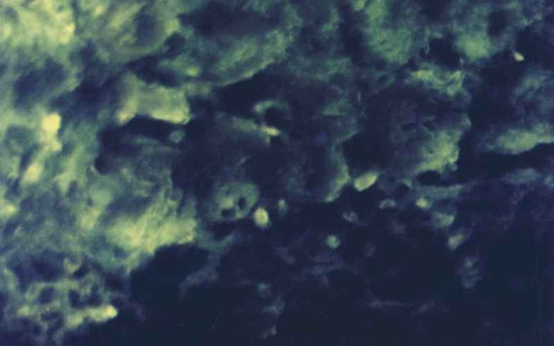 Type-III-collagen-of-the-connective-tissue-component-of-gastric-mucosa