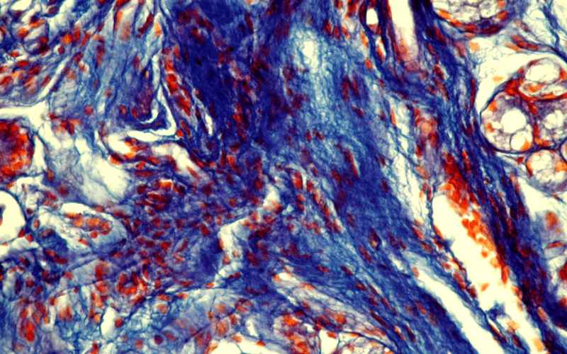 collagen-fibers-and-fragmented-fibers-without-correct-orientation-of-collagen-fibrils-Lamina-propria-of-the-gastric-mucosa