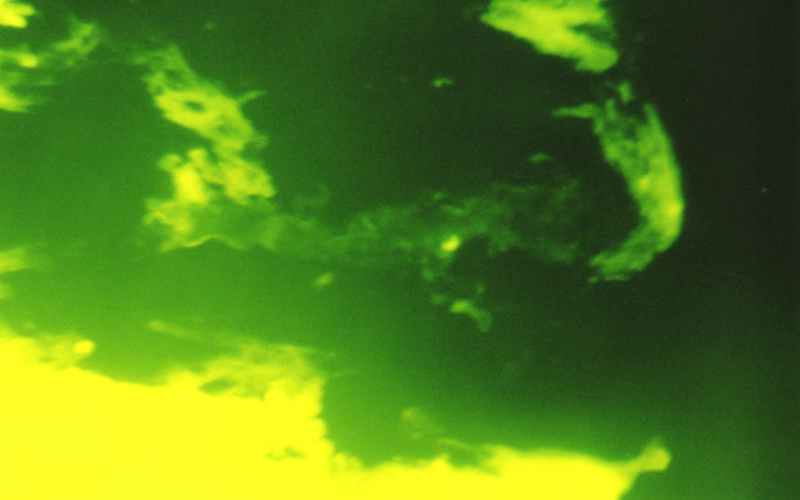 destruction-zones-of-type-I-collagen-in-the-mucous-membrane-of-the-duodenum