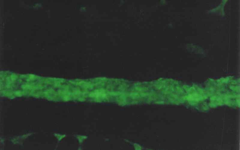 type-IV-collagen-in-basal-membrane-of-gastric-epithelium-1